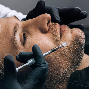 Adult Acne + Scarring