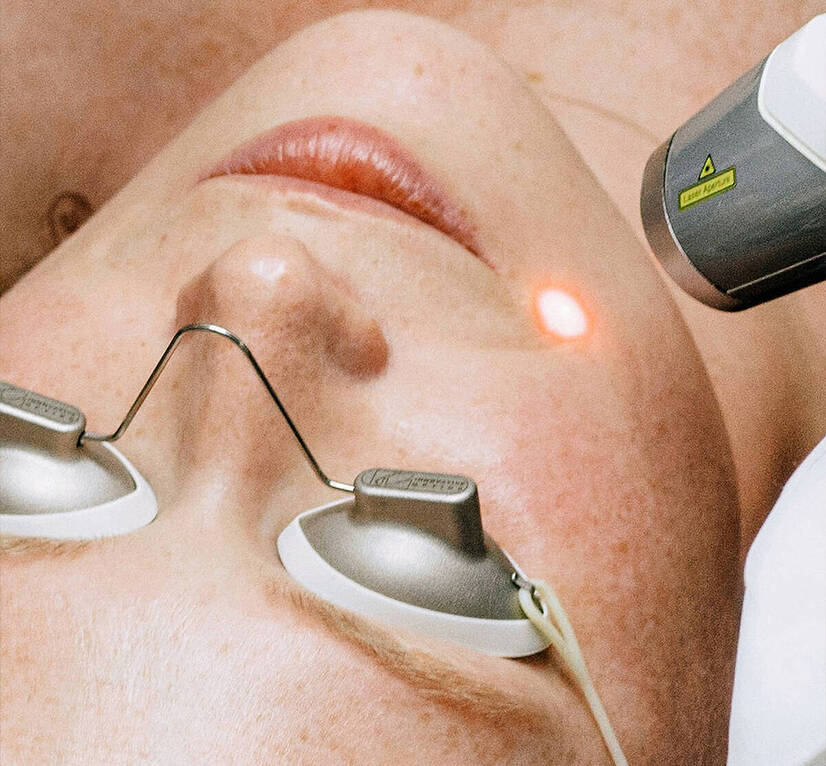 Produtos de skincare indicados para quem realizou procedimentos a laser no rosto.