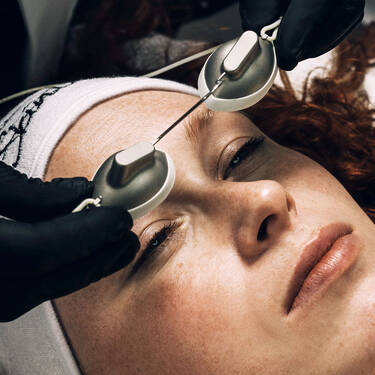 Adult Acne + Scarring