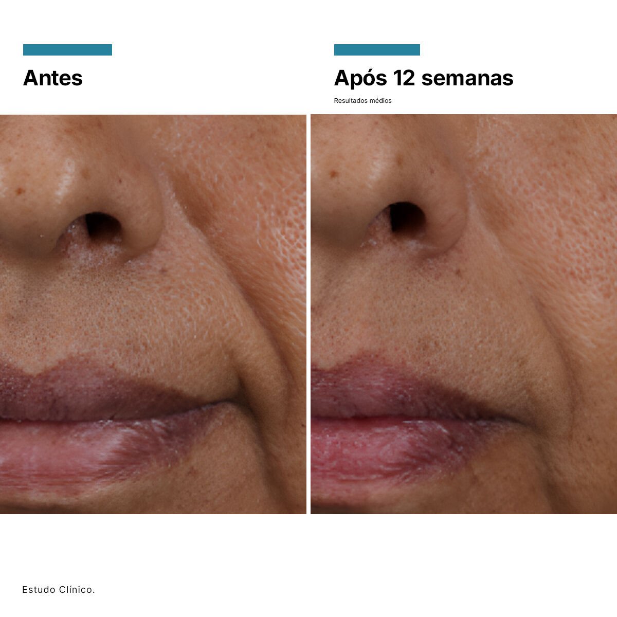 HA Intensifier Multi-Glycan