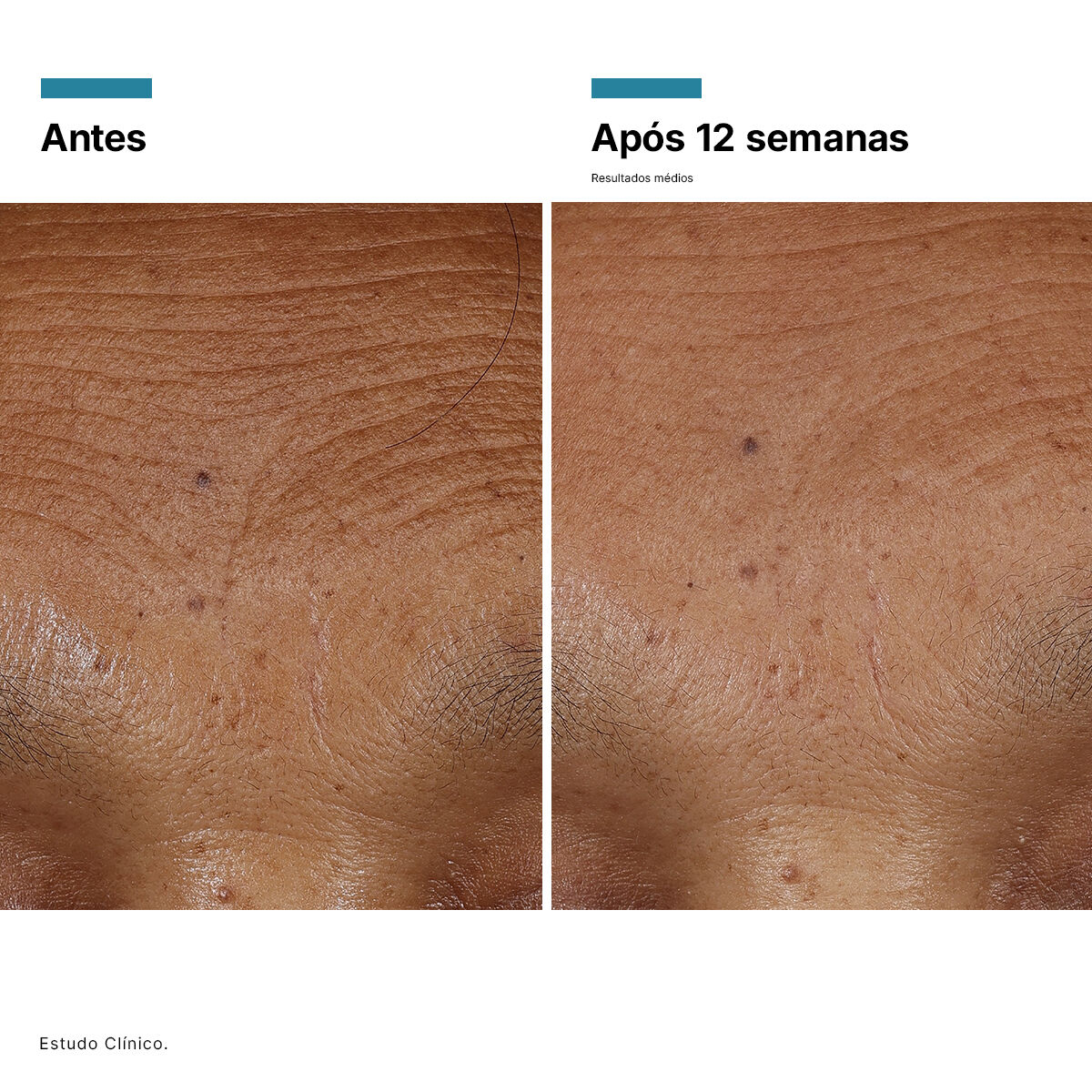 HA Intensifier Multi-Glycan