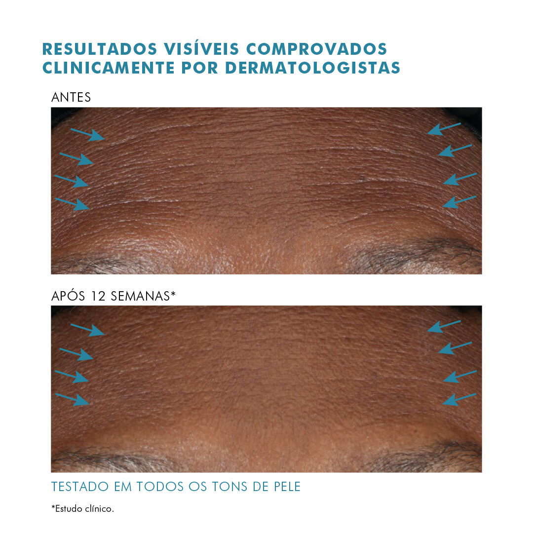 A.G.E. Interrupter Advanced Anti-idade de Alta Potencia