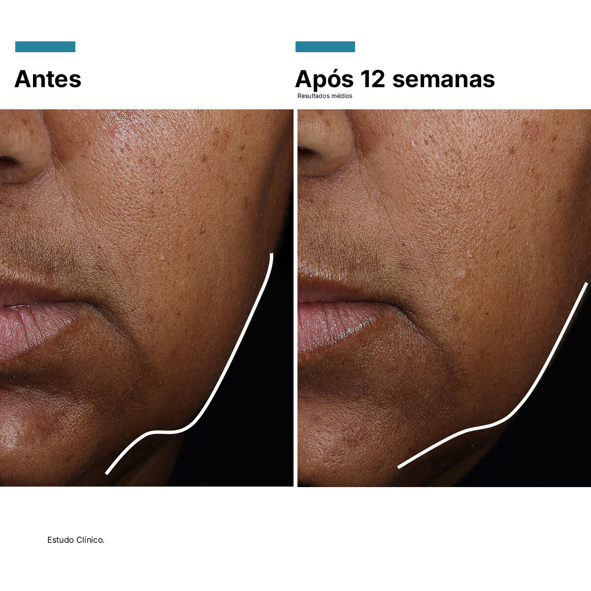 A.G.E. INTERRUPTER ULTRA SERUM