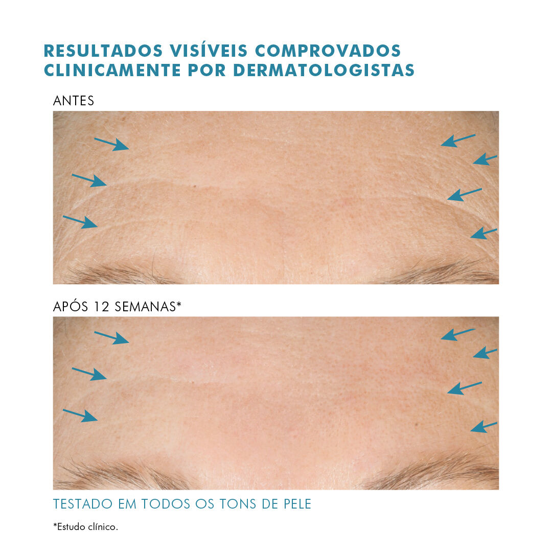 A.G.E. Interrupter Advanced Anti-idade de Alta Potencia