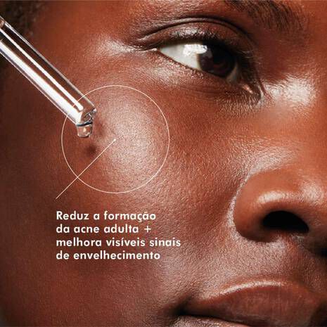 O serum Blemish + Age Defense de tripla acao reduz acne e poros dilatados, alem de melhorar sinais de envelhecimento